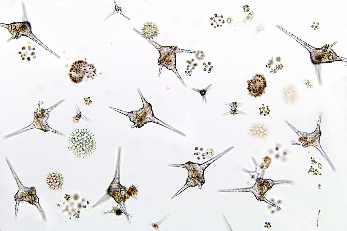 Brown dinoflagellate slime coating reef tank rockwork