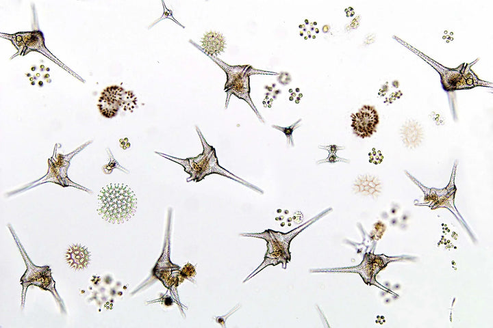 Brown dinoflagellate slime coating reef tank rockwork